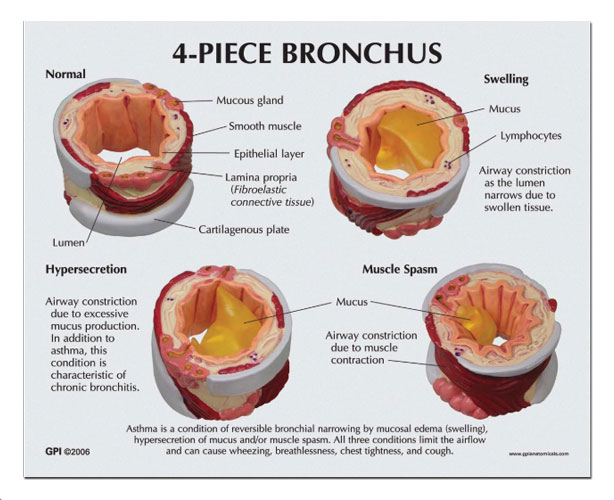 Bronchus Anatomy Model - 4 Piece