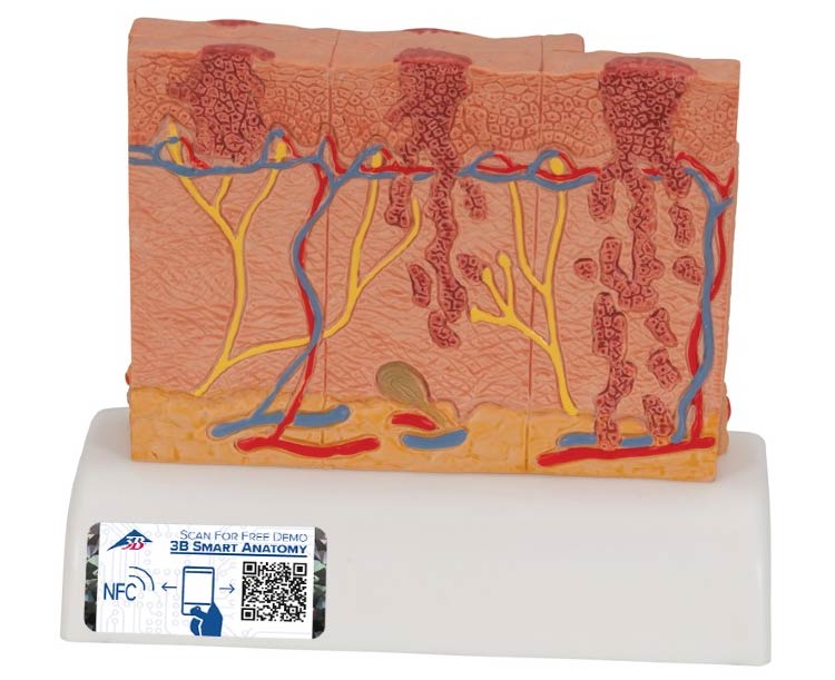 3B Scientific Skin Cancer Stages Model