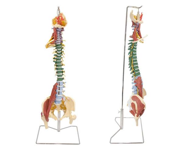 Anatomical World Wide Muscle Spine With Disorders Model with Stand