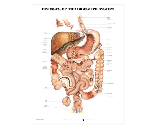 Anatomical World Wide Diseases Of The Digestive System Anatomical Chart