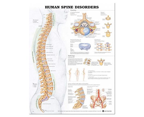 Anatomical World Wide Human Spine Disorders Anatomical Chart