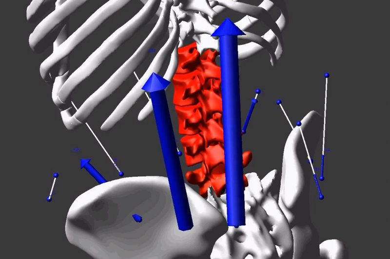 Spine Issue
